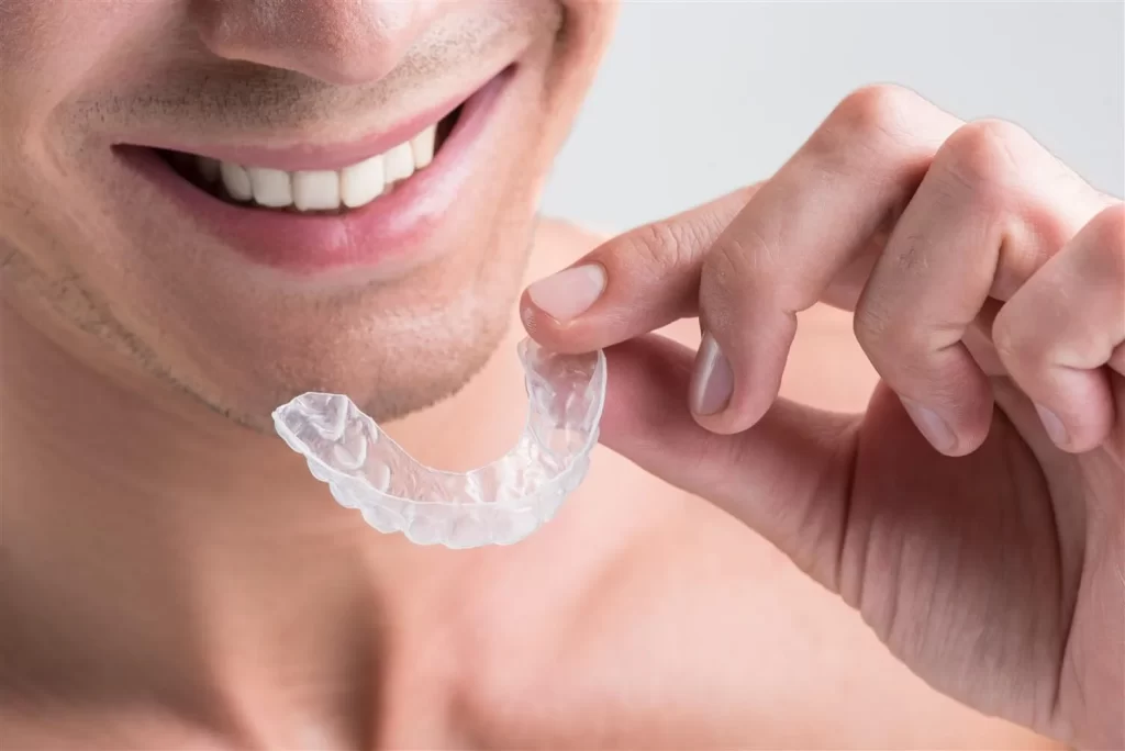 Adult Cosmetic Orthodontics Img