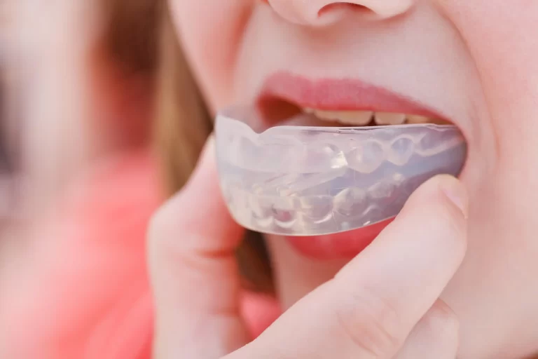 Caring for Athletic Mouth Guards