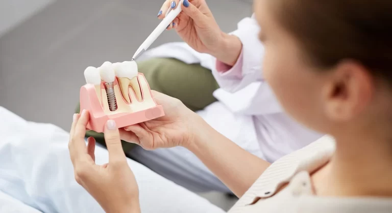 Dental Implants