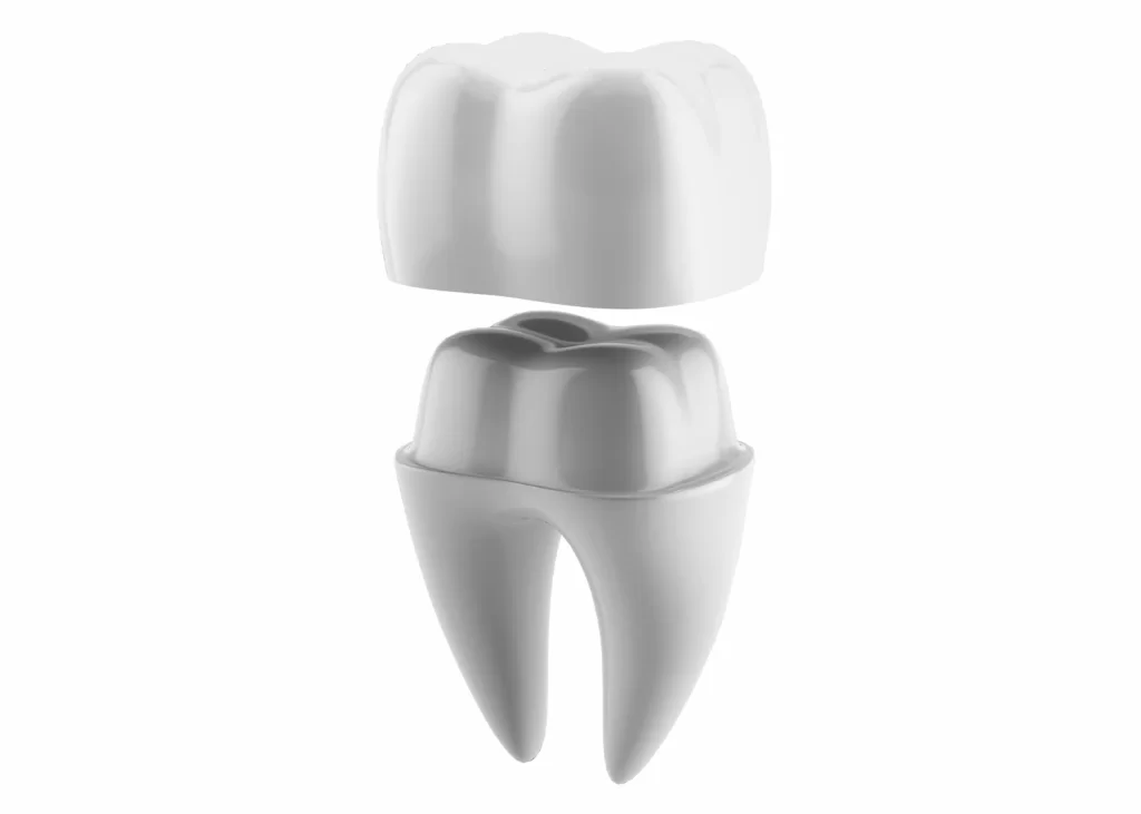 Porcelain Crowns Img