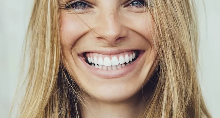 Teeth Whitening