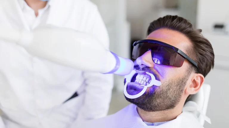 Opalescence® Teeth Whitening
